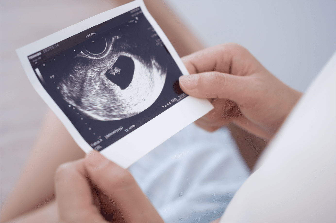 Understanding Incomplete Miscarriage: Causes, Symptoms, and Treatment Options