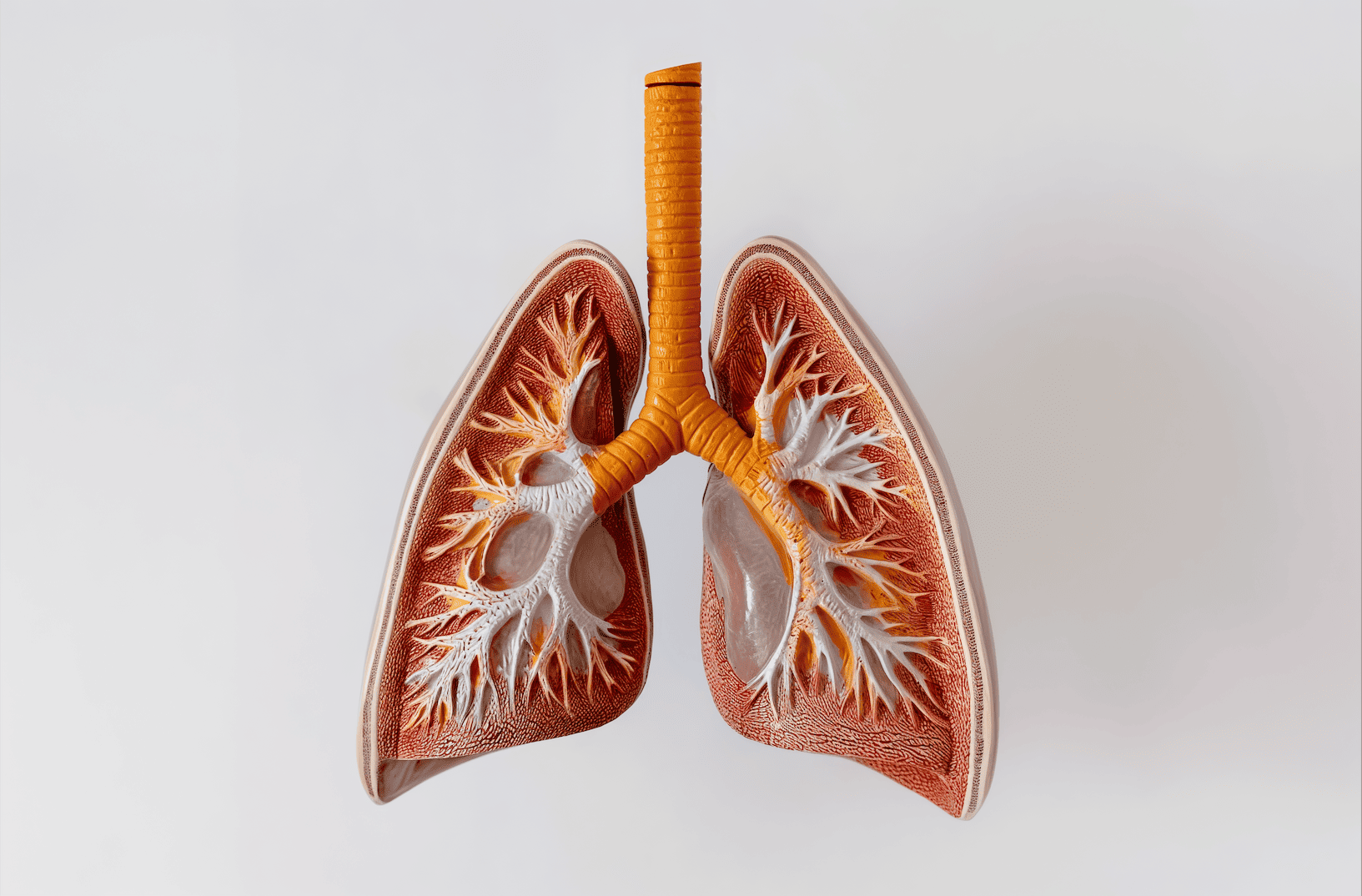 Understanding Lung Abscess: Causes, Symptoms, and Treatment Options